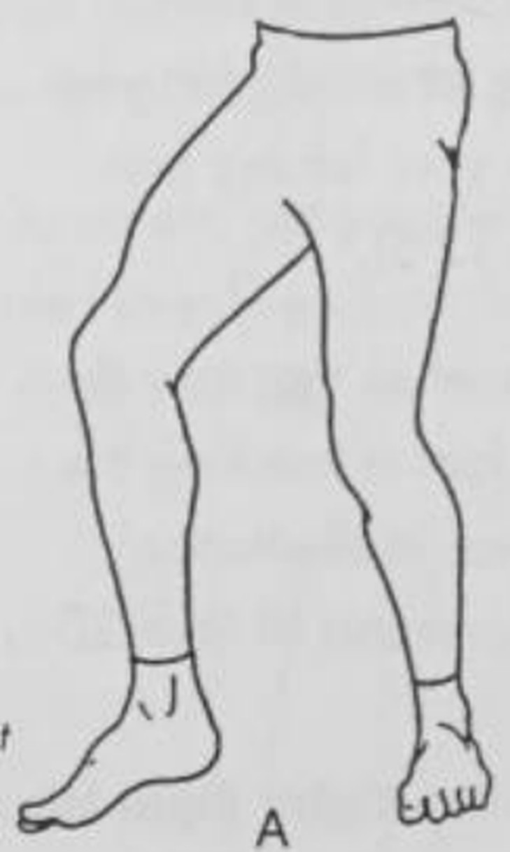 figure 12-14