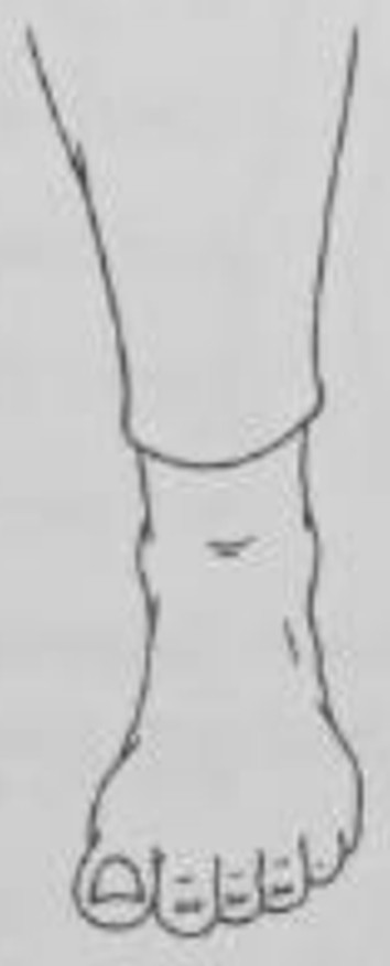 figure 6-11