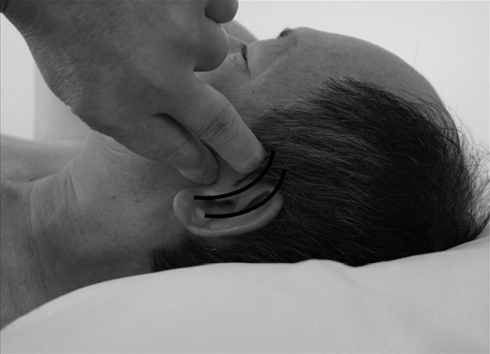 Bước 5 — ấn và rung huyệt ermen (耳門, TB-21)