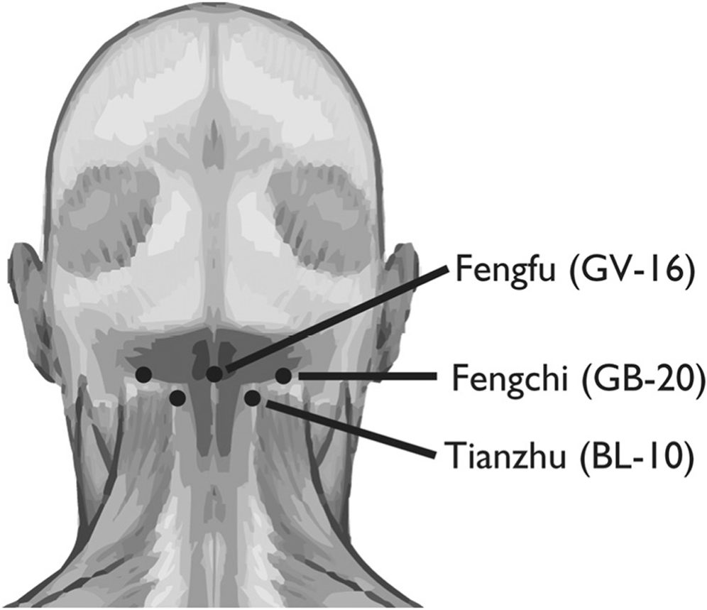 Các huyệt Thiên Trụ, fengchi và Phong Phủ