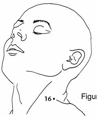 Bước Tới Kết Bảy Sao (Step Up to Form Seven Stars) — hình 133, ảnh gốc trang 68