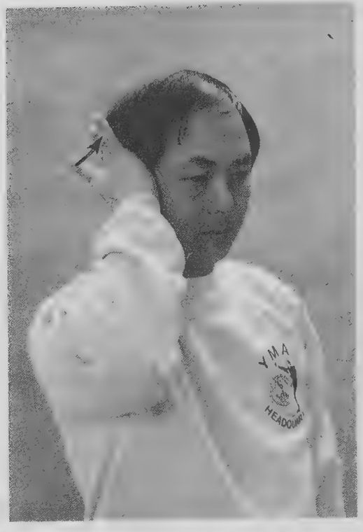 Lòng bàn tay ép tai, ngón trỏ gõ lên đầu