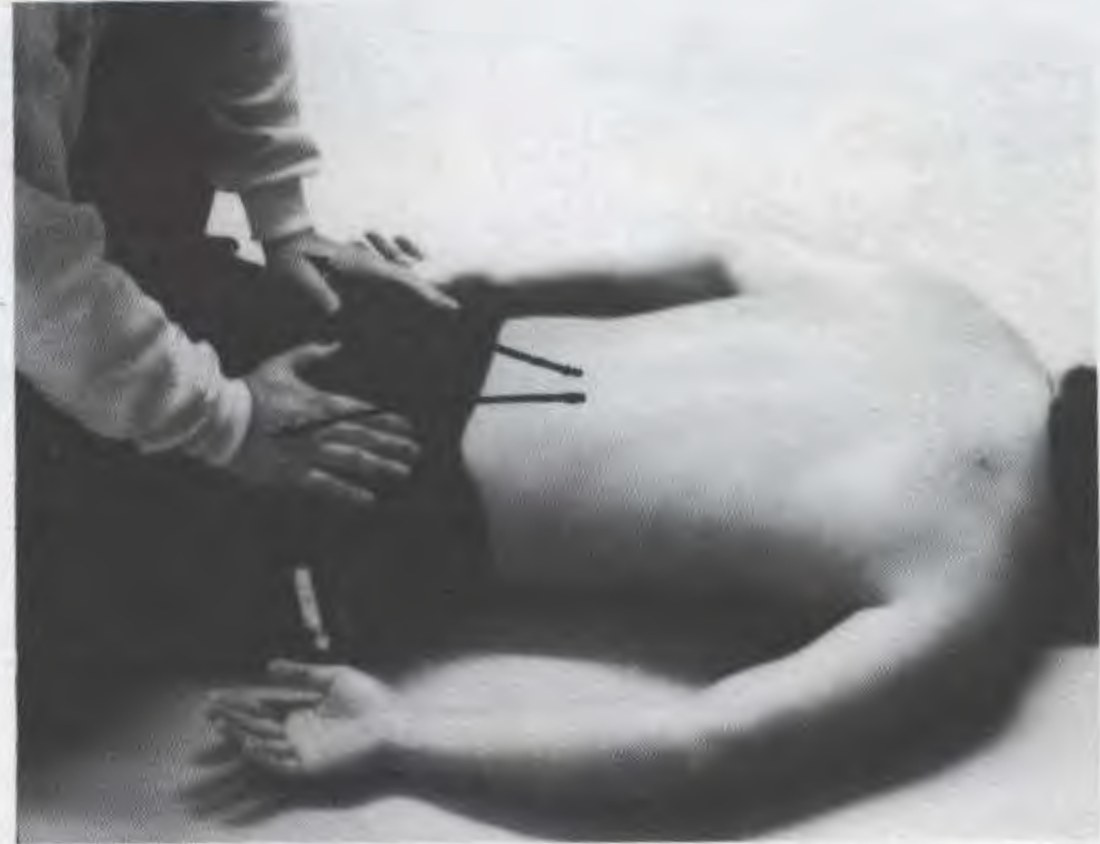 Tản Khí xuống hai đùi