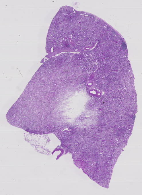 An example of the overall view of the kidney tissue image.