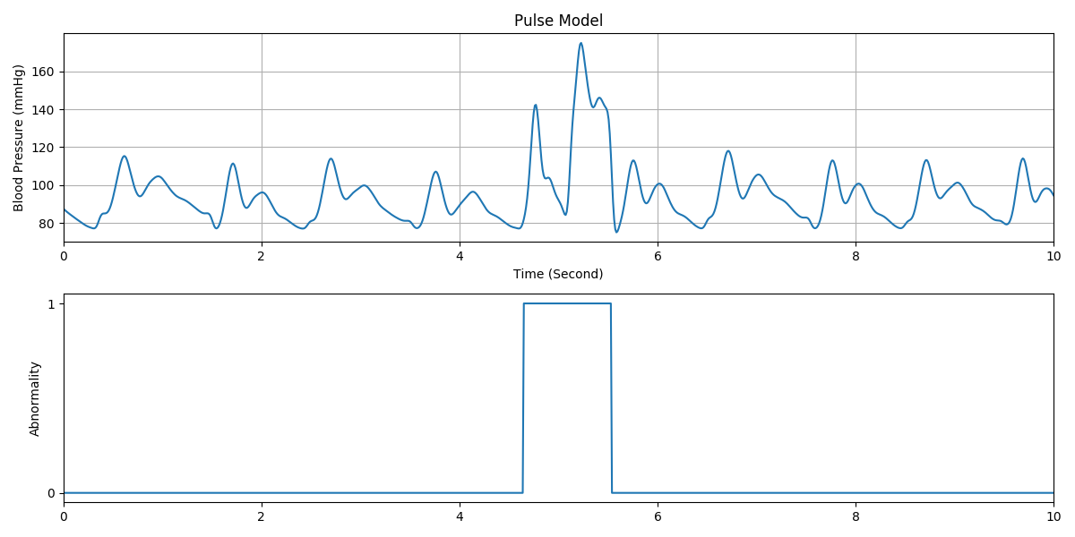 Sample pulse waveform with abnormality indicator