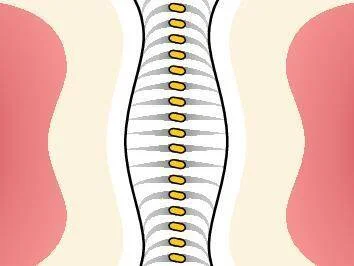 牙間刷刷毛完整貼合牙面的橫切面示意