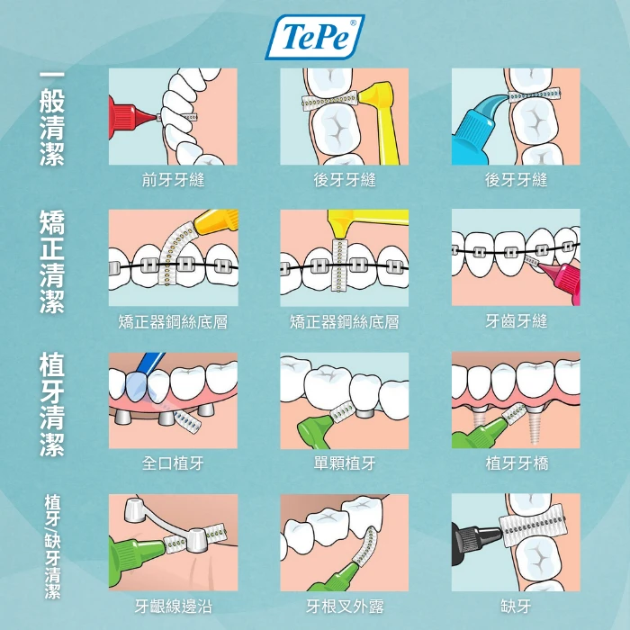 牙間刷適用於多種口腔清潔情境