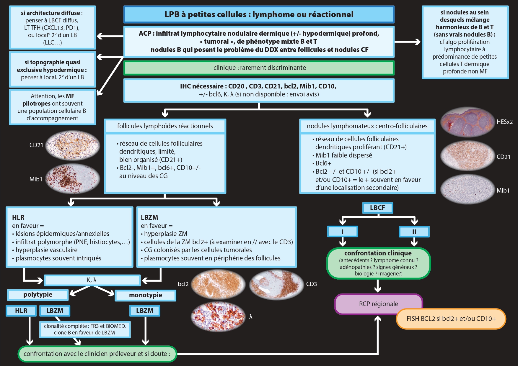 https://raw.githubusercontent.com/mathias2a/mathias2a.github.io/main/lymphoprolif%20T%20petites%20cellules.jpg