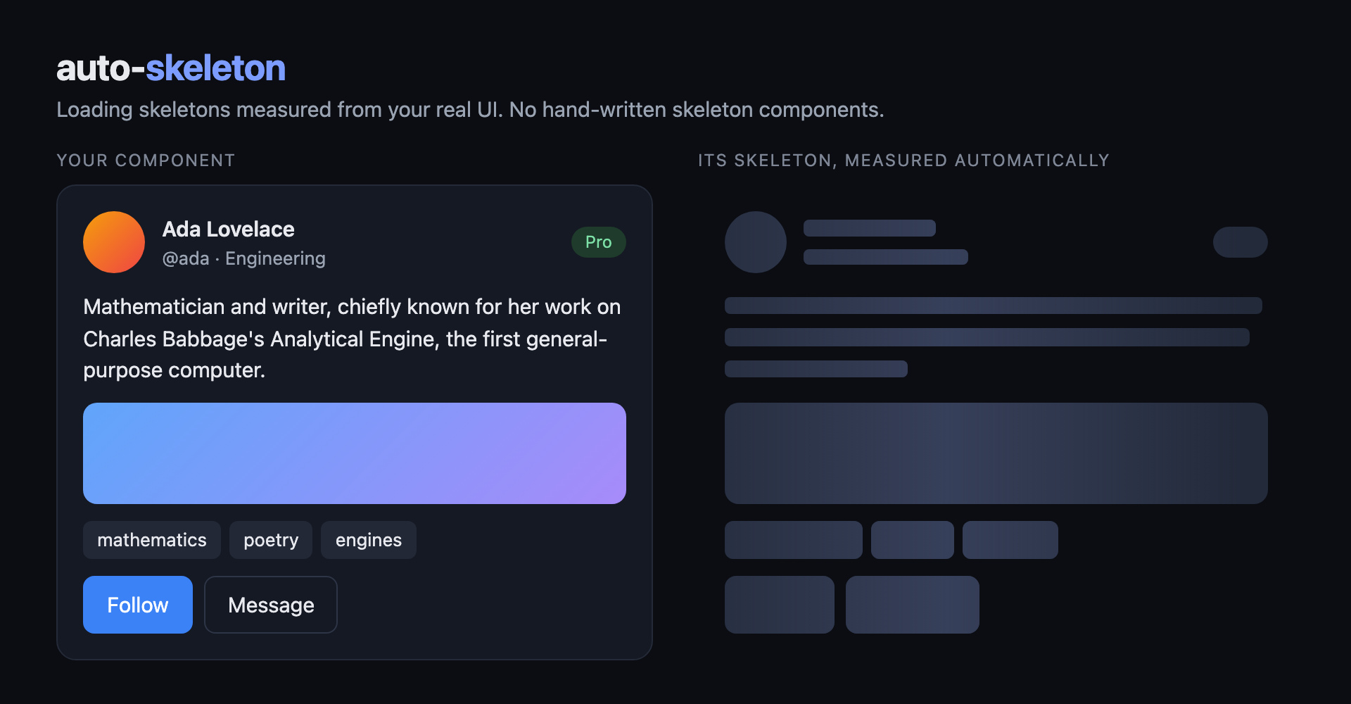 A profile card next to the skeleton loader auto-skeleton generated from it