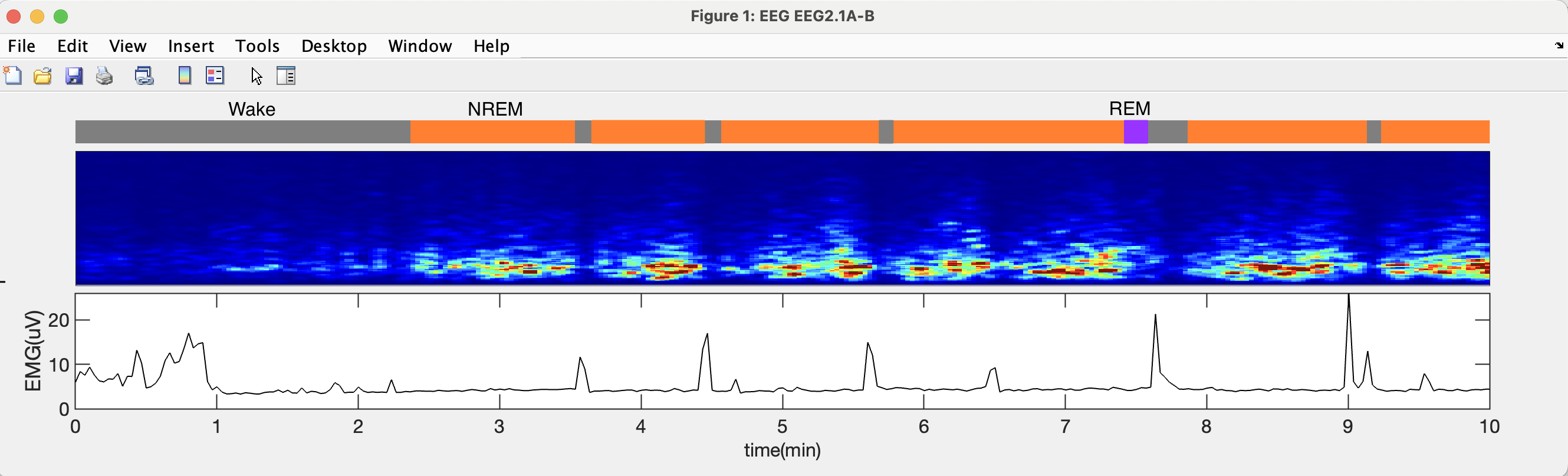 GitHub - thepenglab/edfEEG: MATLB package for processing edf EEG data ...