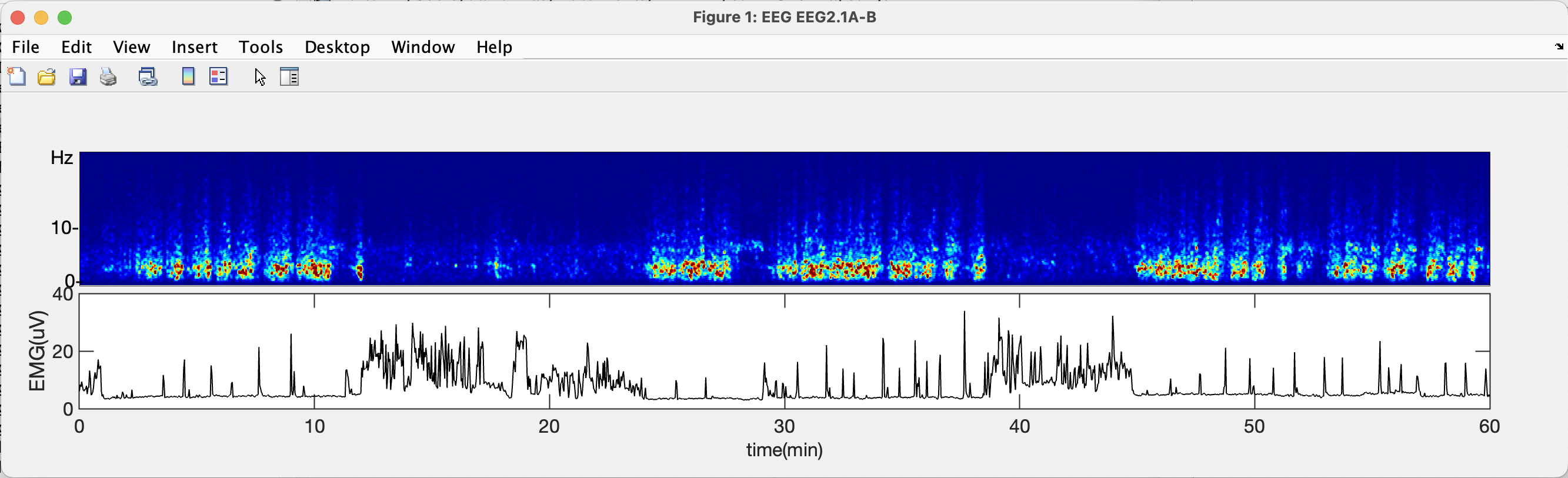 GitHub - thepenglab/edfEEG: MATLB package for processing edf EEG data ...