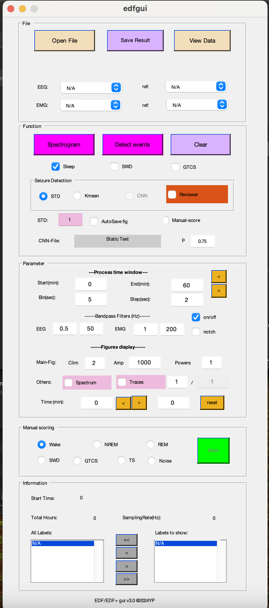 GitHub - thepenglab/edfEEG: MATLB package for processing edf EEG data ...