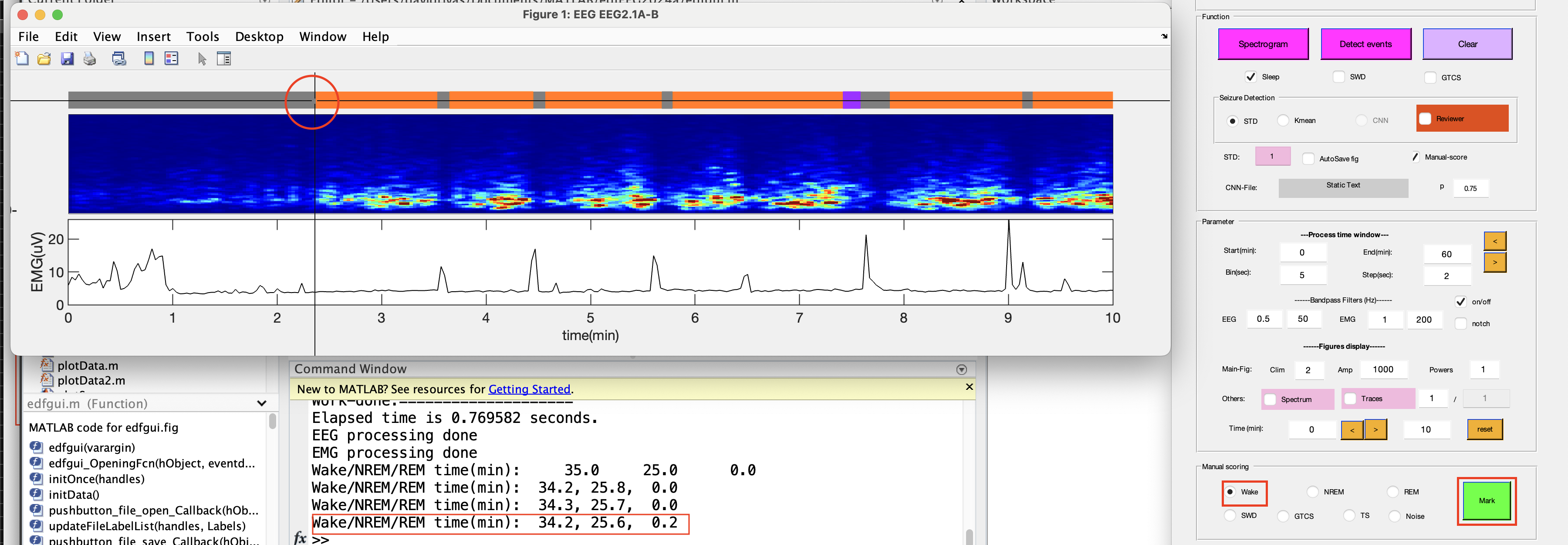 GitHub - thepenglab/edfEEG: MATLB package for processing edf EEG data ...