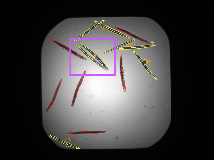 There is a cluster of worms (in purple box) in this image where the formula counts only one worm. This is related to the fact that the skeleton has detected only 3 endpoints. A more precise skeleton would improve results. Otherwise, it counts well.