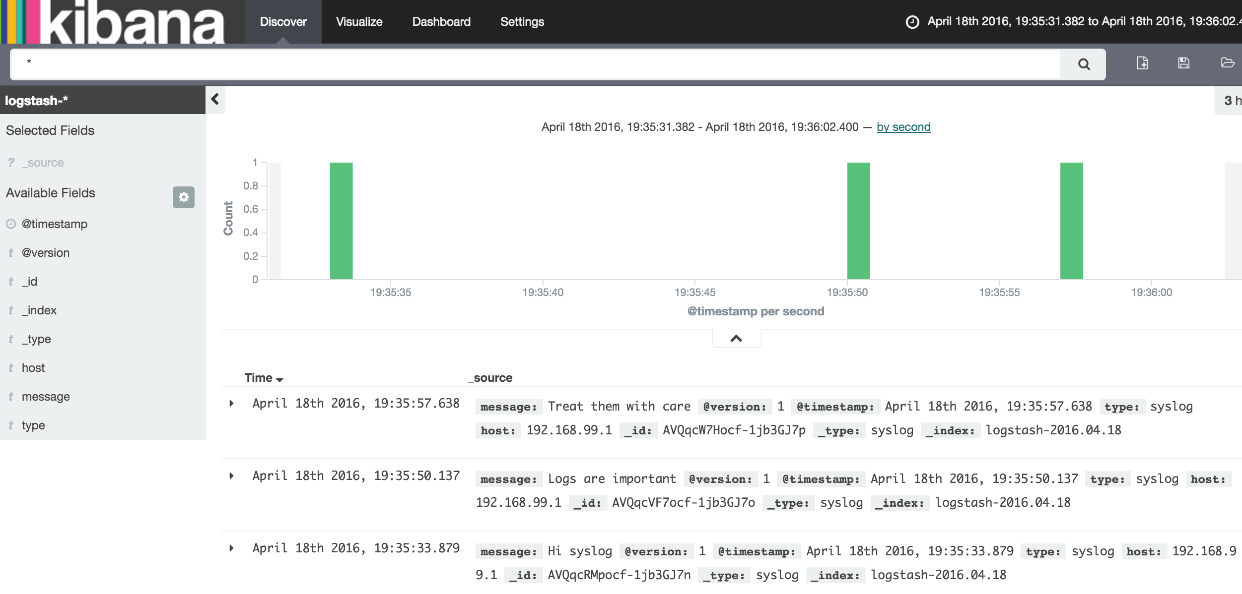 Kibana