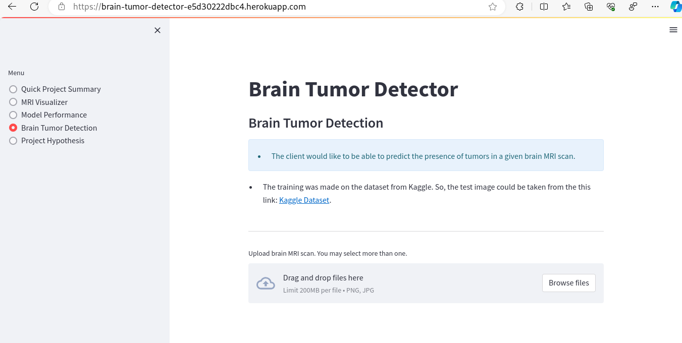 Brain Tumor Detection 01