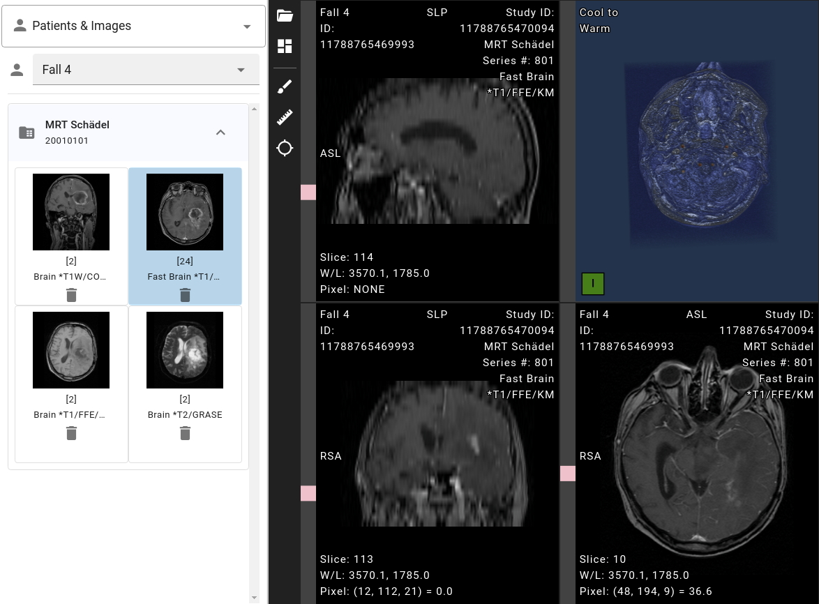 A screenshot of a sample VolView session