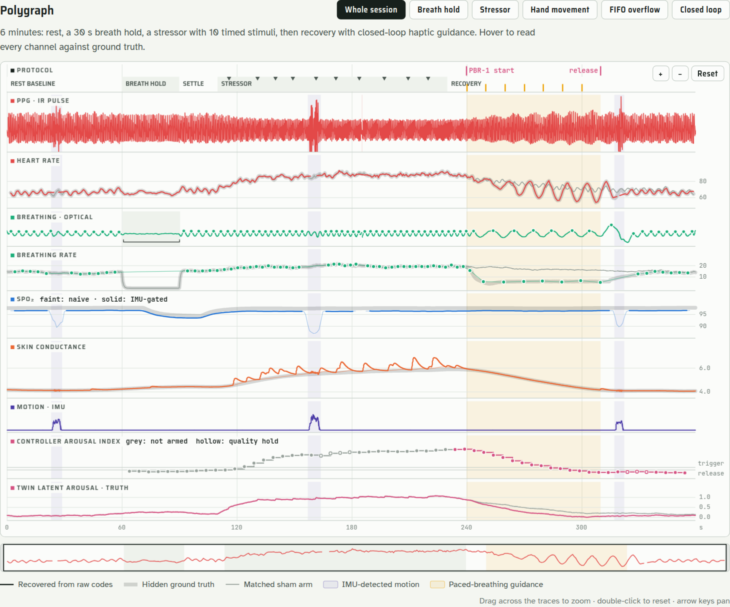 CIRCLE's report view: physiological traces recovered by its signal pipeline, plotted against hidden synthetic reference signals.