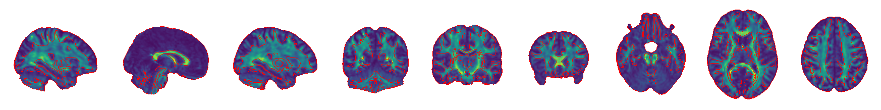 FA with MNI_1mm brain image segmentation