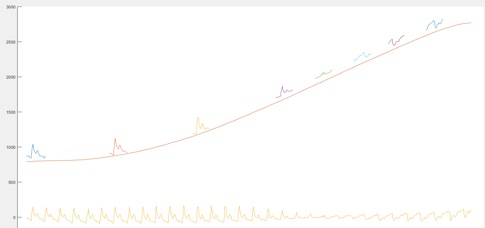 GitHub - tt-loveslife/DSP: Process pulsewave signal with matlab script