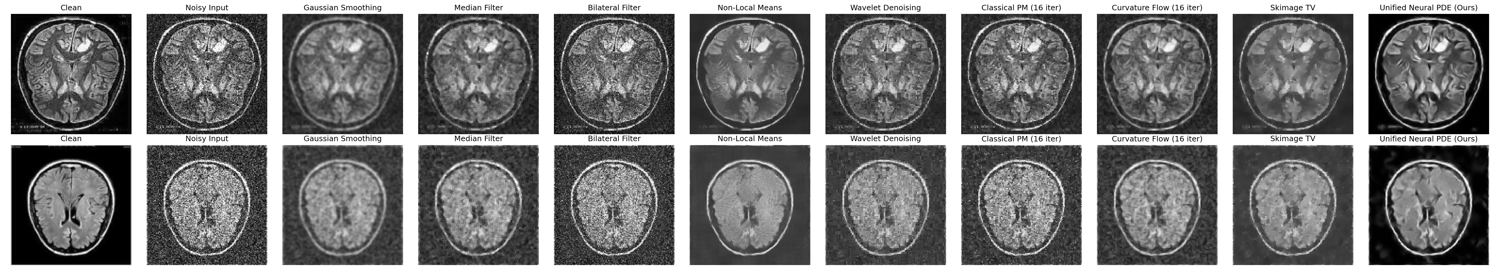 Full denoising comparison grid