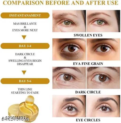 Eye Patches for Dark Circles with 24k Gold | 60 Pcs Eye Cooling Gel Pads | Hydrogel Eye Patch Mask with Collagen for Relaxing Eyes - Abnlas Women’s Daily-Use Beauty & Self-Care