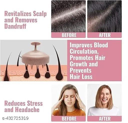 Head Massager , Scalp Massager, Scalp Massager For Hair Growth, Hair Massager, Hair Massager For Hair Growth, Hair Scalp Massager Brush, Hair Wash Brush, Head Scrubber, Hair Scalp Massager Shampoo Brush(Marble Pink) - Abnlas Women’s Daily-Use Beauty & Self-Care
