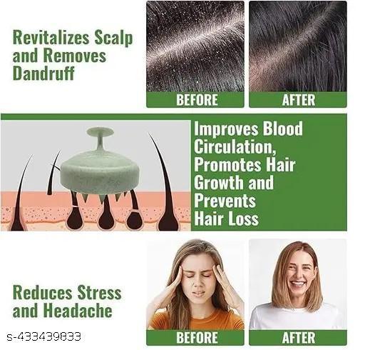 Scalp Massager , Scalp Massager, Head Massager, Scalp Massager For Hair Growth, Hair Massager, Hair Massager For Hair Growth, Hair Scalp Massager Brush, Hair Wash Brush, Head Scrubber, Hair Scalp Massager Shampoo Brush (Marble Green) - Abnlas Women’s Daily-Use Beauty & Self-Care