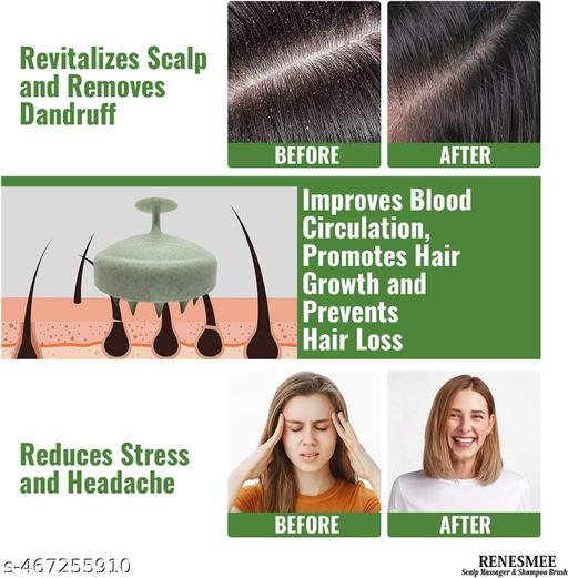 Stylish Hair Scalp Massager Shampoo Brush (Marble Pink & Green) With Soft Bristles For Men & Women | Promotes Hair Growth & Removes Dandruff | Couples Combo of 2 | Scalp Scrubber & Head Massager - Abnlas Women’s Daily-Use Beauty & Self-Care