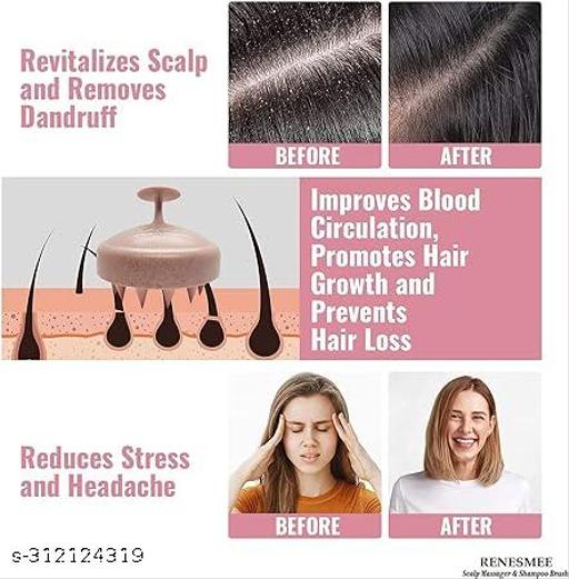 Hair Scalp Shampoo Massager (Marble Pink) - Abnlas Women’s Daily-Use Beauty & Self-Care