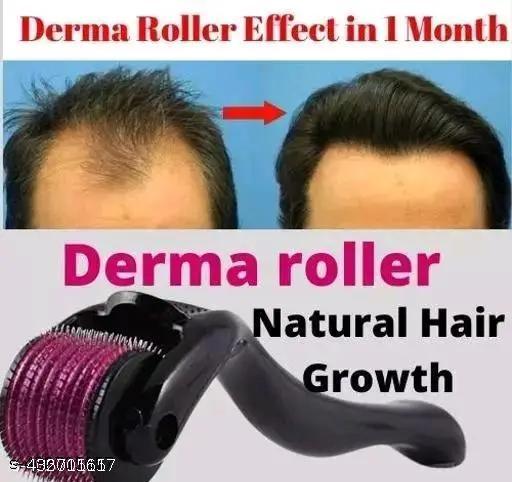 Revivo Hairfall COntroller Derma Roller with 540 Titanium Alloy Micro Needles 0.5 mm | Suitable for Beard Also | Reduces Hair Fall | Stimulates Hair Follicles | Easy to use - REVIVO