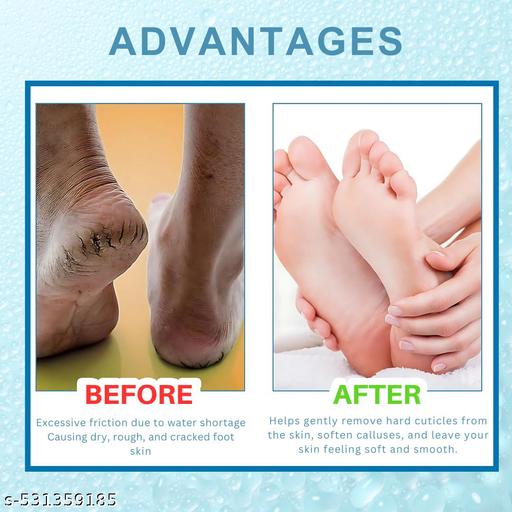 Foot Crack Cream | Foot Crack | Foot Cream | Foot Crack Cream for Man & Woman - 50GM(Pack Of 3) - Anuloria 