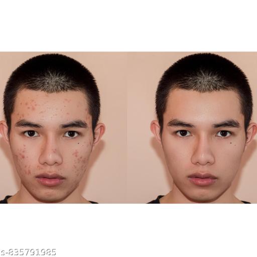 Oceann Face Wash for Men and Women | Fight Acne & Pimples, Brighten Skin, Clears Dirt, Oil Control, Refreshing Feel - Multi-Action Formula - Lumae