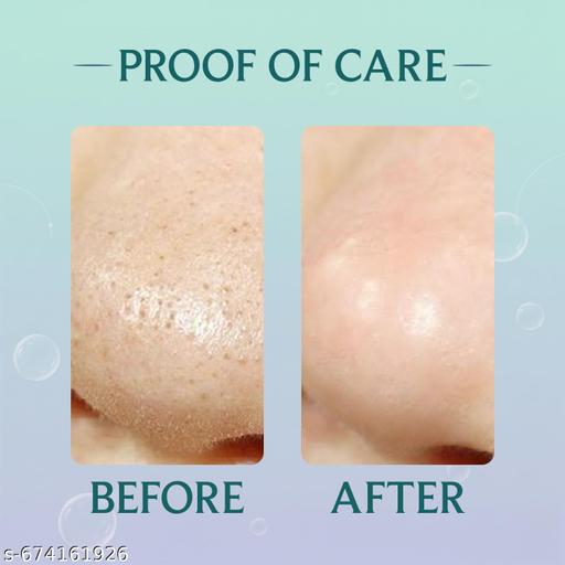 Pristar 10 Piece Blackhead Remover Strips for Men and Women with Bamboo Charcoal - Lumae