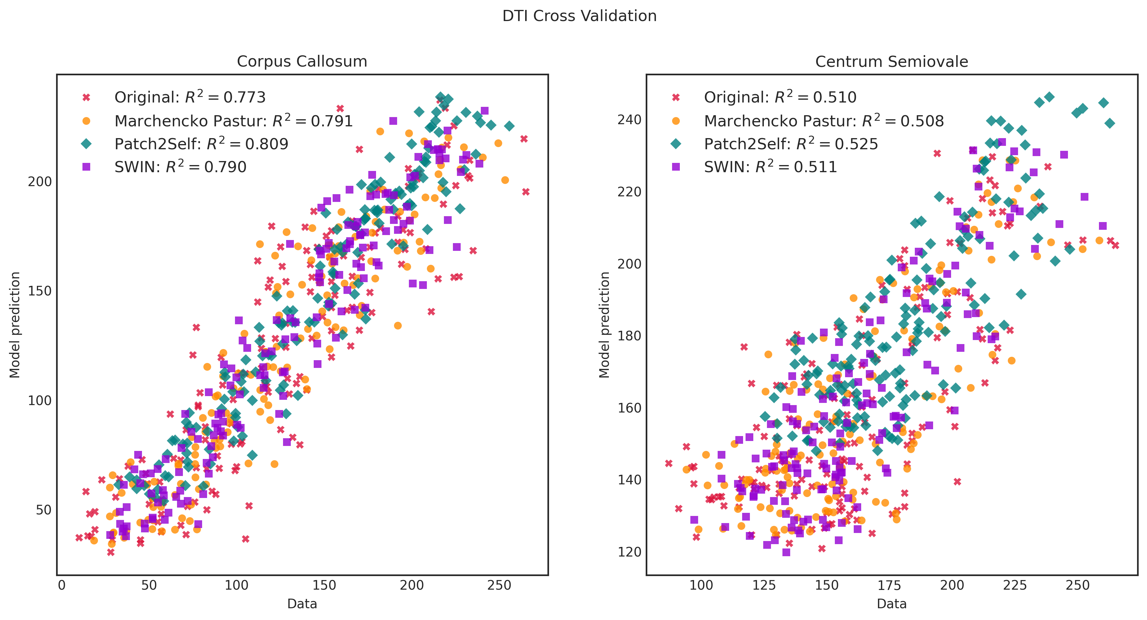 P2S DTI Example