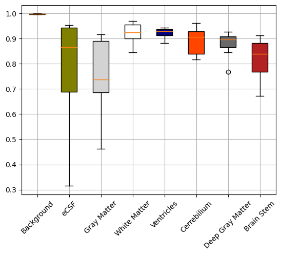 Whisker-Box Plot of 3D SDUNet on FeTA2021 Dataset.