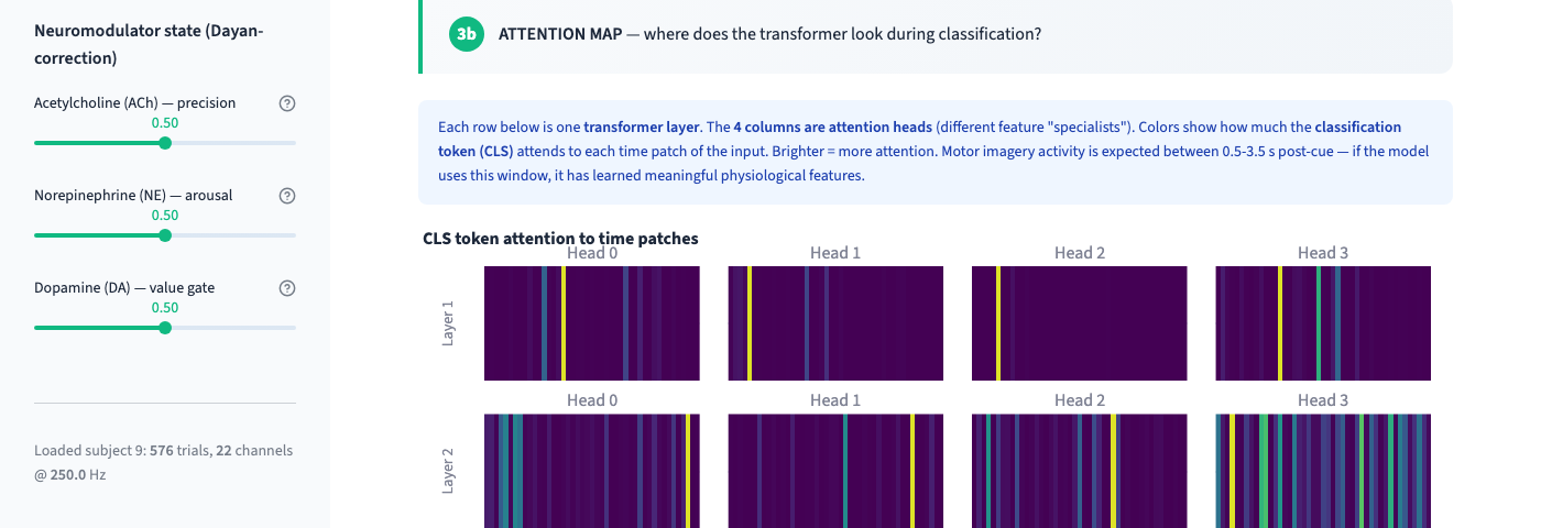 Attention map