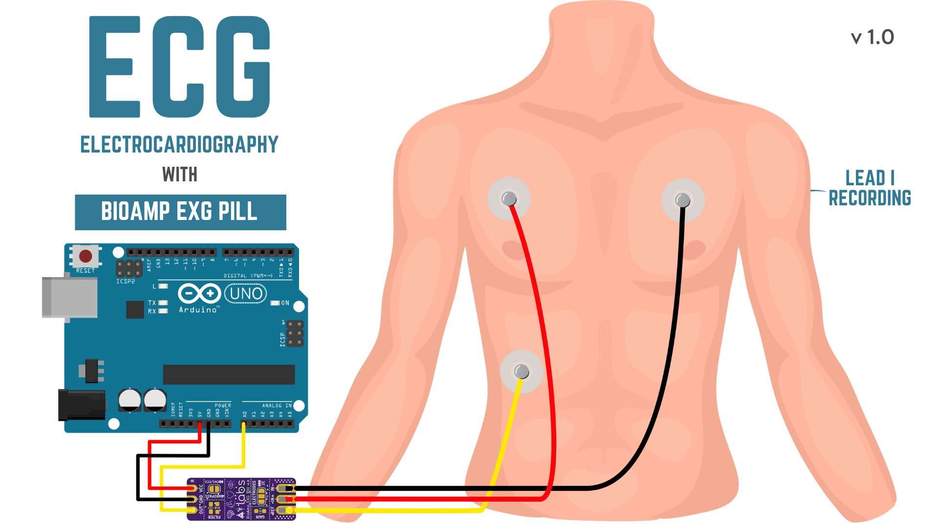 BioAmp EXG Pill - Electrocardiography (ECG) Lead 1