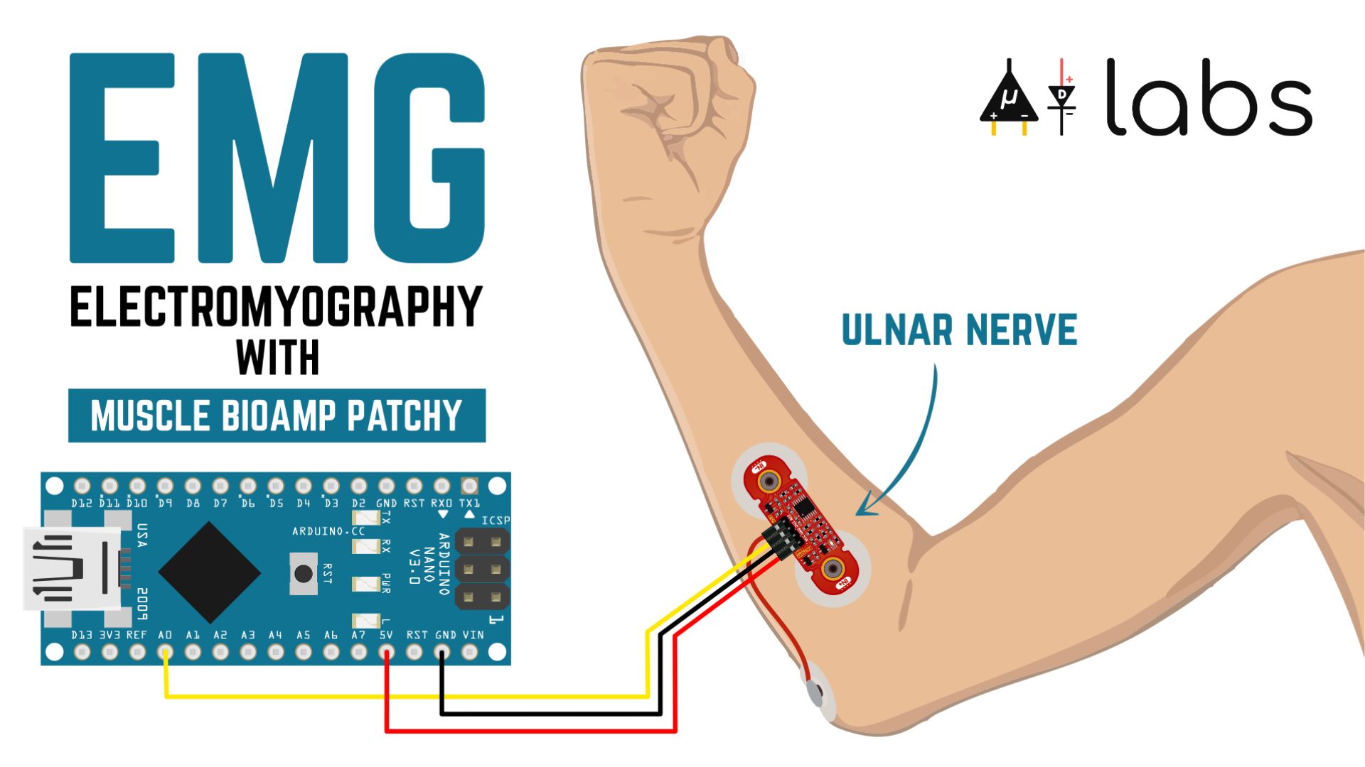 Muscle BioAmp Patchy Connections