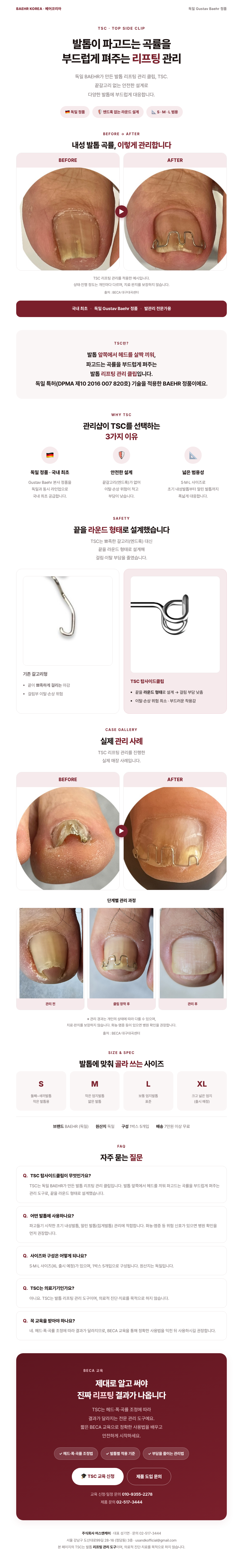 TSC 탑사이드클립 상세