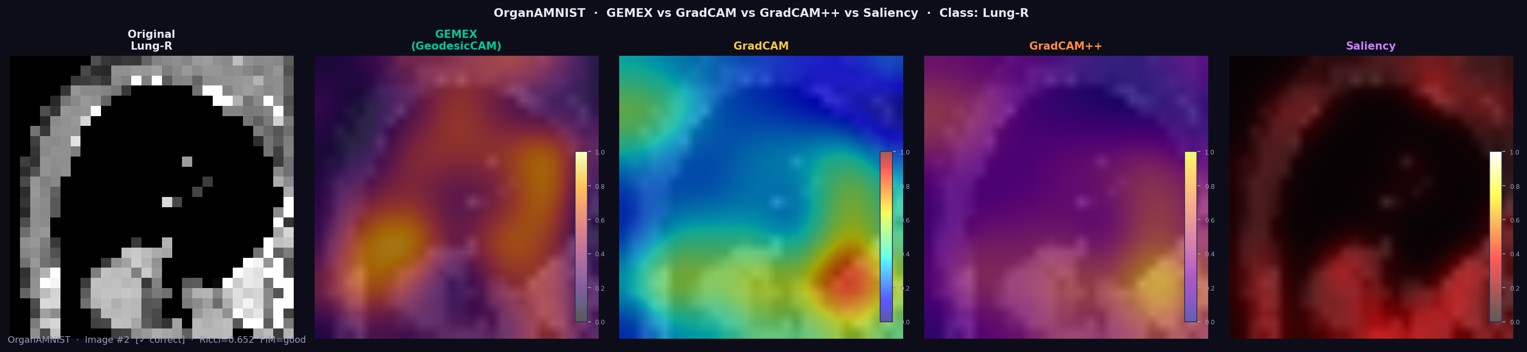 GEMEX vs GradCAM — abdominal organ