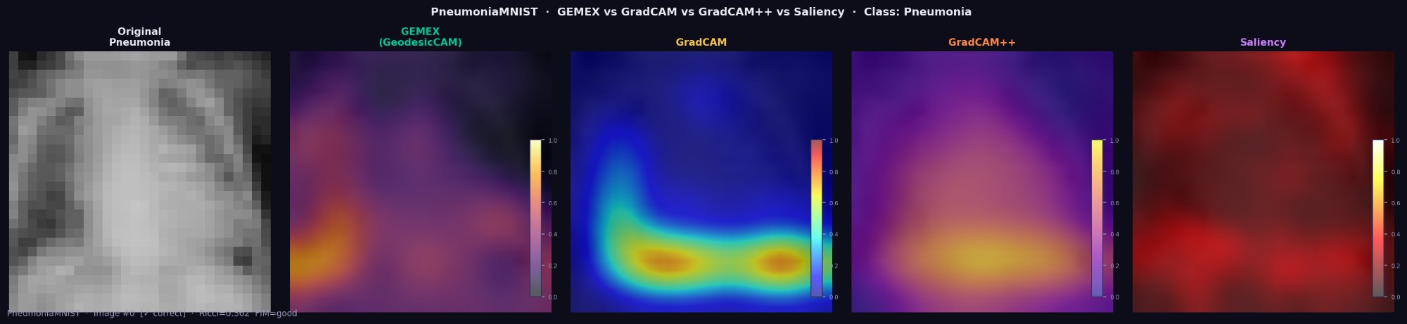 GEMEX vs GradCAM — chest X-ray