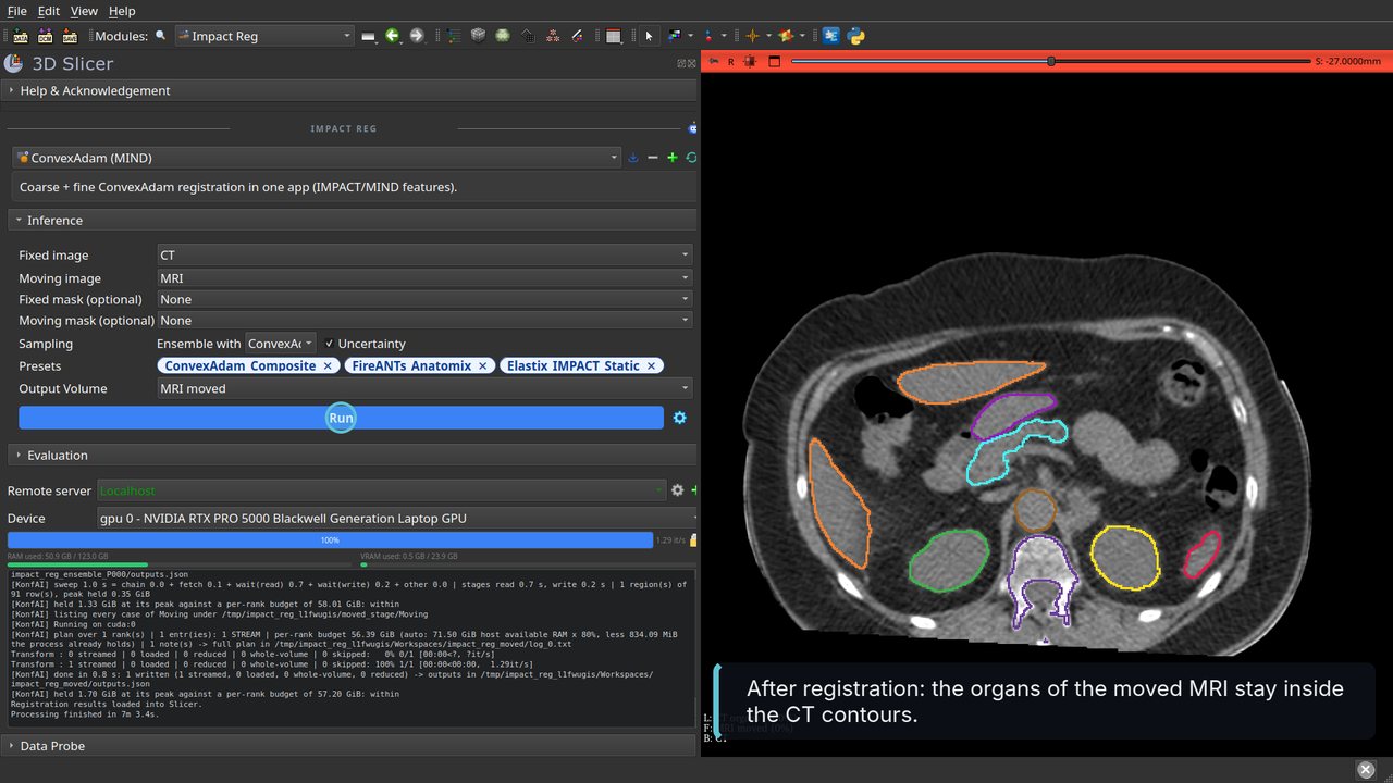 The moved MRI under the CT organ contours in Slicer