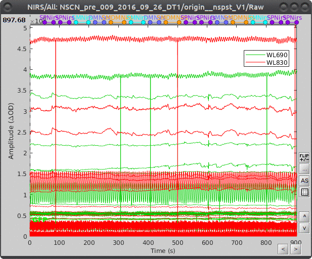 signal zoom