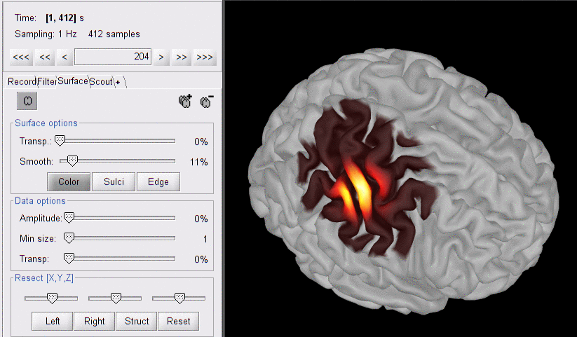 head model parameters