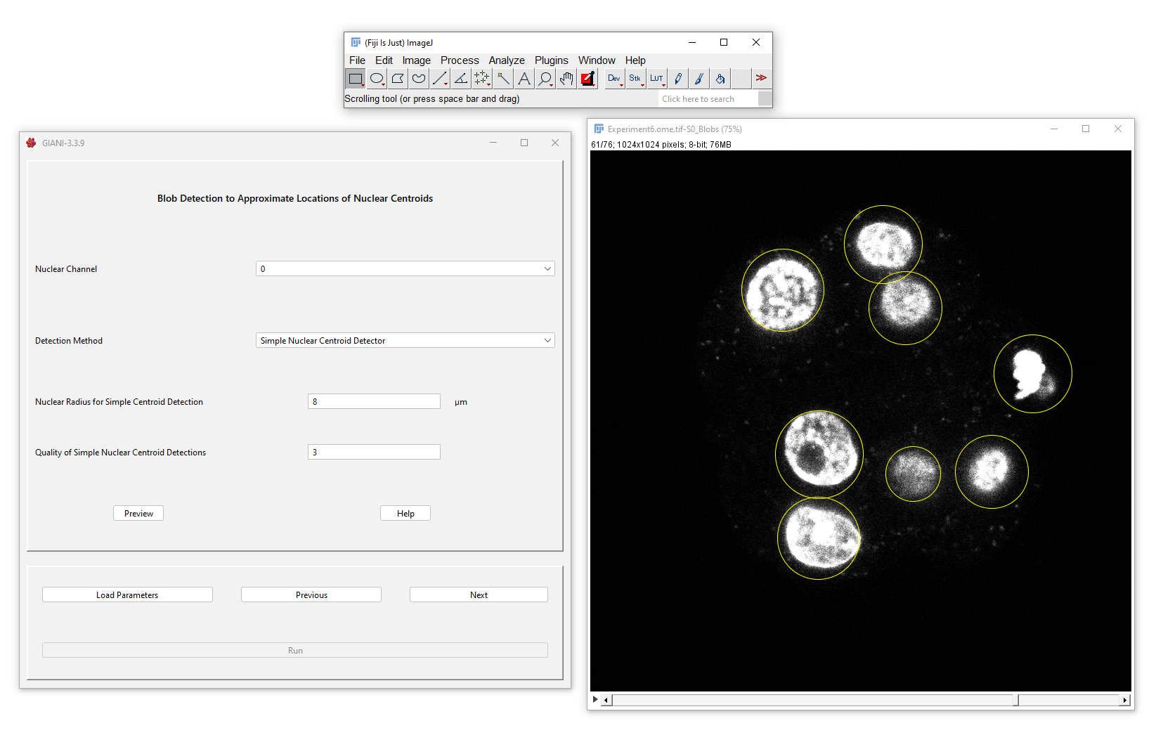 GIANI Detect Nuclei Centres Preview
