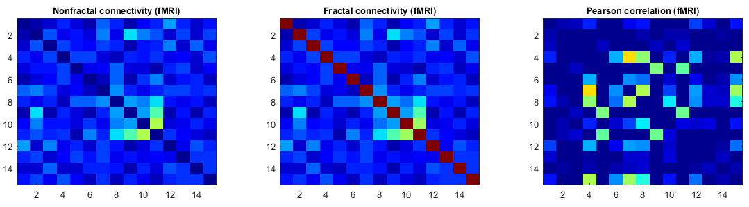 Nonfractal connectivity and fractal connectivity