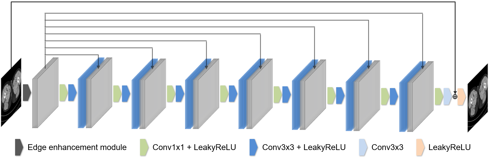 EDCNN: Edge enhancement-based Densely Connected Network with Compound ...