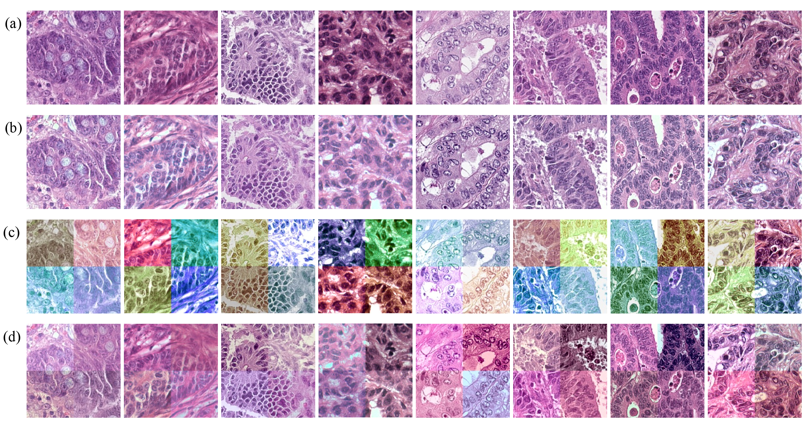 The illustrative patch examples of (a) raw images, (b) stain-normalized images, (c) stain-augmented images, (d) images processed with the proposed RandStainNA