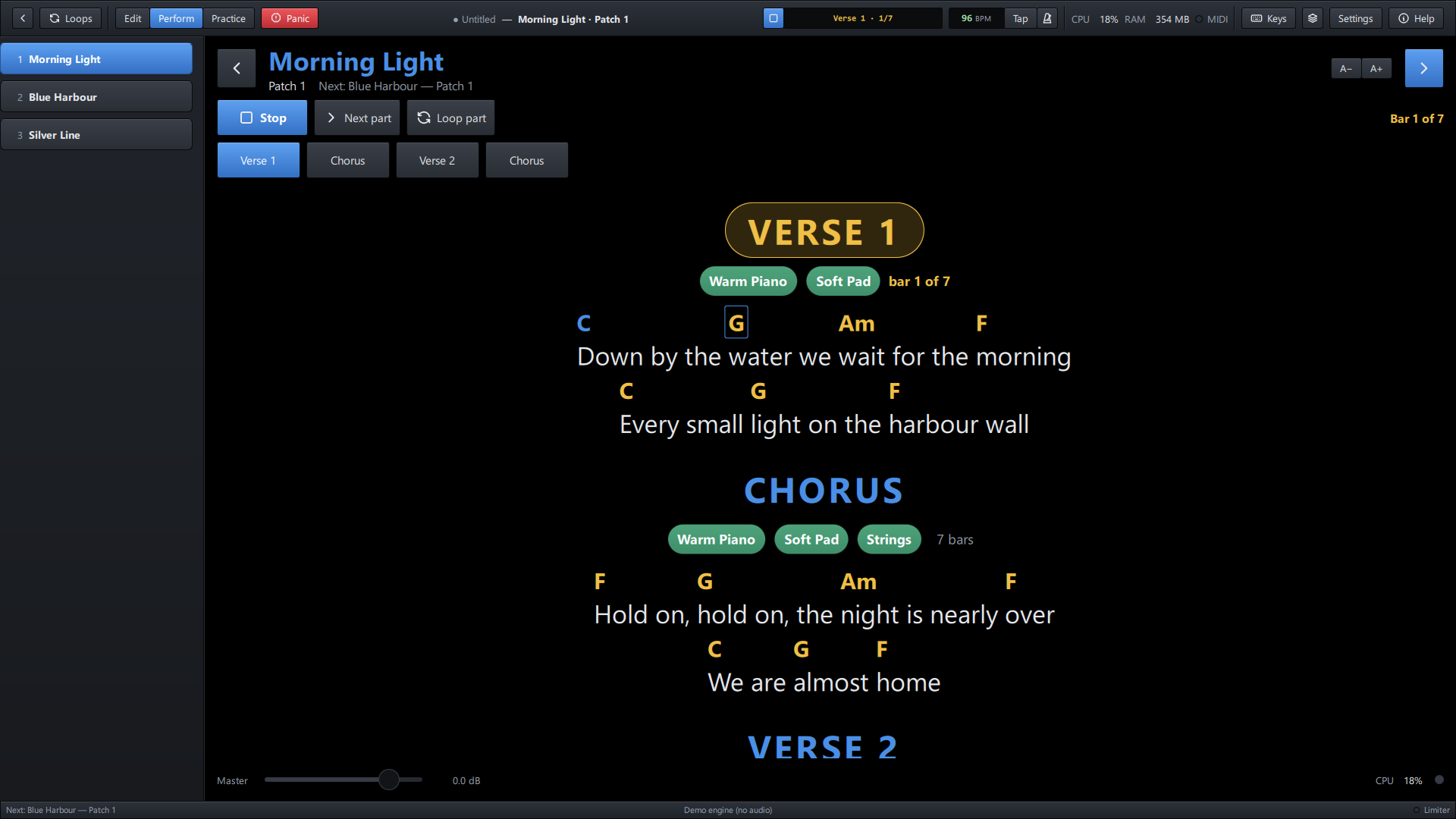 Perform mode: the song playing, big Play, Next part and Loop part buttons, the parts as tiles and the chart
